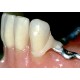 OPERA SYSTEM® Acetal Dental