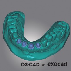 MODEL CREATOR - OS-CAD BY EXOCAD
