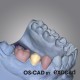 PROVISIONAL - OS-CAD  BY EXOCAD