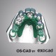 PROTHESE PARTIELLE - OS-CAD  BY EXOCAD 