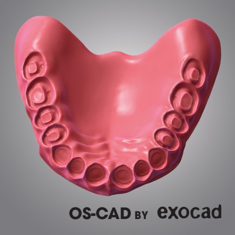 PROTHESE COMPLETE - OS-CAD  BY EXOCAD 