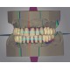 FULL DENTURE - OS-CAD  BY EXOCAD 