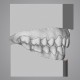 ORTHODONTIE - OS-CAD  BY EXOCAD 