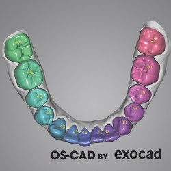 ORTHODONTIE - OS-CAD  BY EXOCAD 