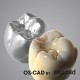 TRU-SMILE - OS-CAD BY EXOCAD
